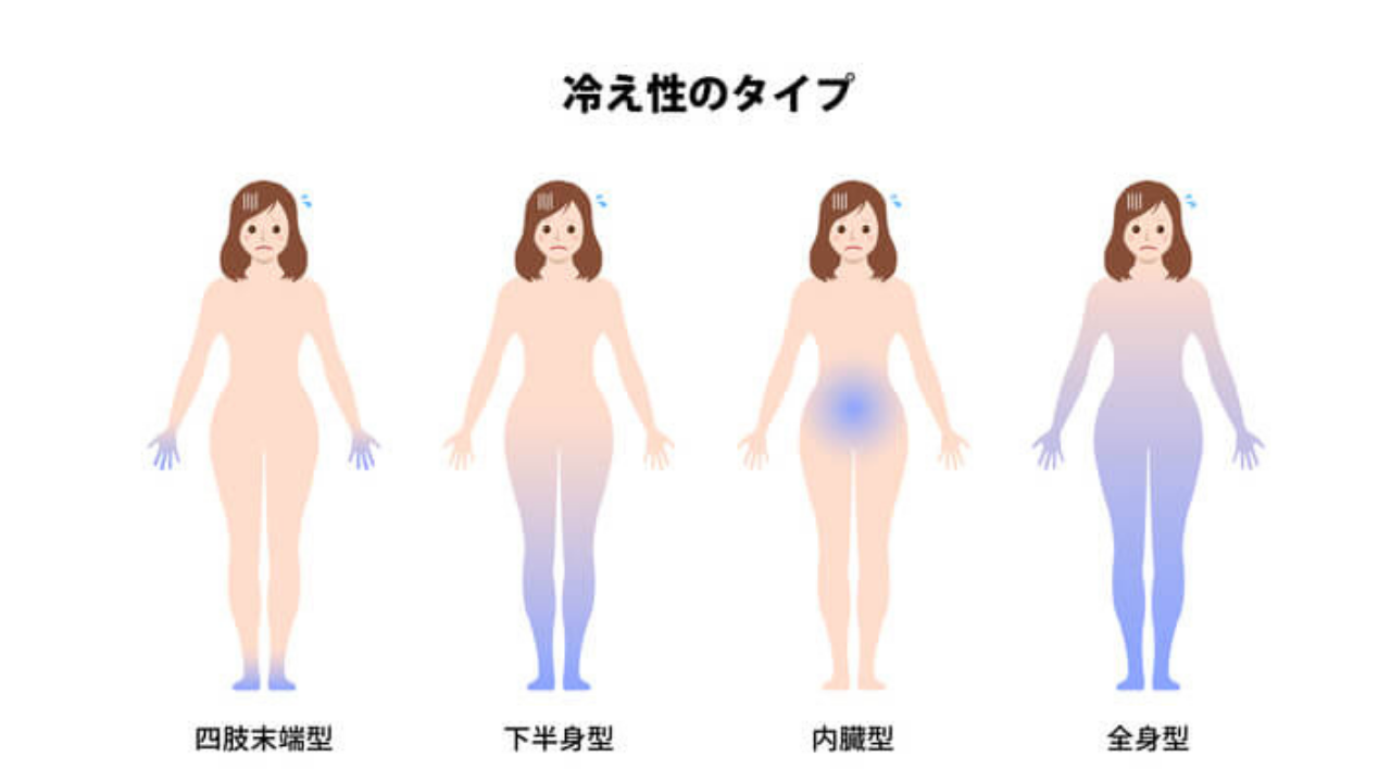 冷え性のタイプ別