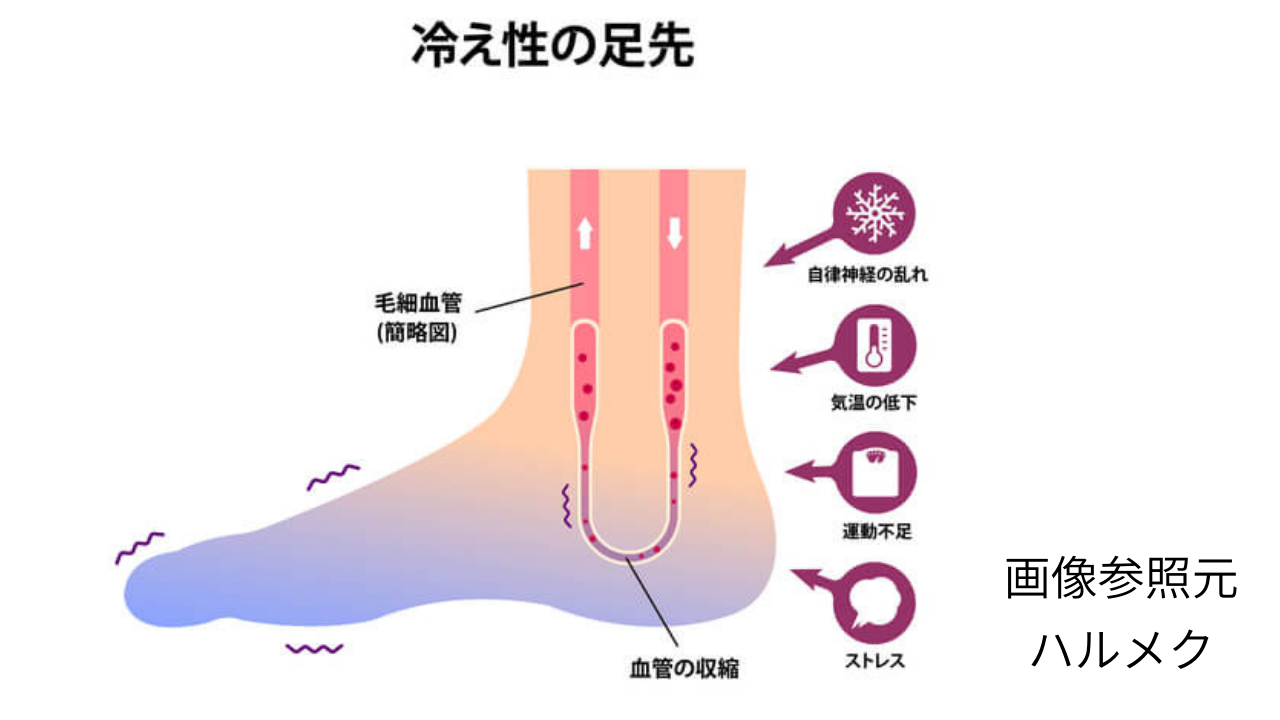冷え症｜冷え性
