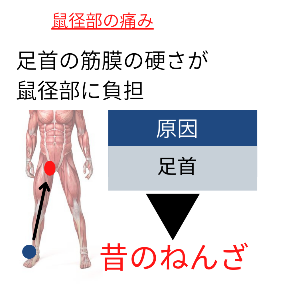 グロインペイン症候群、股関節の痛みの原因と改善例