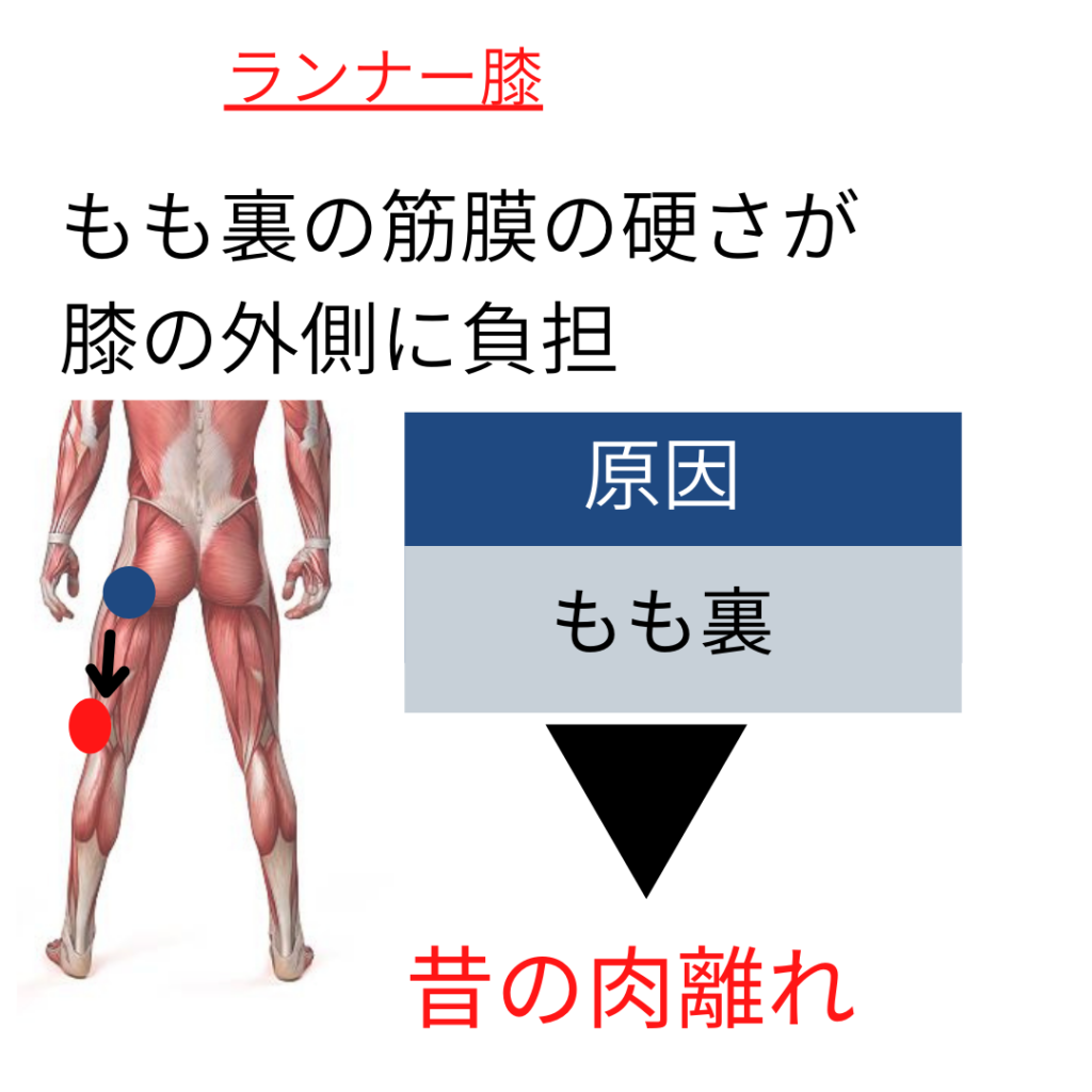 ランナー膝