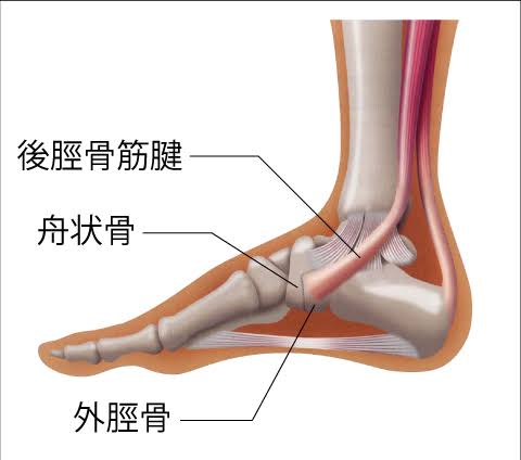 有痛性外脛骨障害の原因